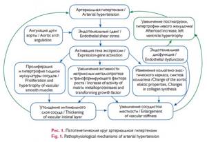 Статья диагностика. Коарктационный синдром.