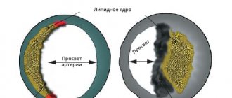 Рисунок 1