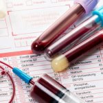 Сдвиг лейкоцитарной формулы влево