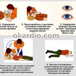 cardiopulmonary resuscitation