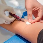 Alkaline phosphatase. Normal blood levels in women by age, causes of increased, decreased, treatment 