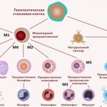Scheme of hematopoiesis with precursor cells of acute myeloid leukemia