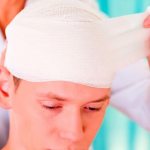 Brain shunt for hydrocephalus