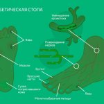 Diabetic foot symptoms