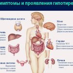 Symptoms of hypothyroidism