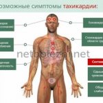 Symptoms of the appearance of tachycadia