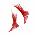 симптомы сужения сосудов