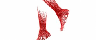 symptoms of vasoconstriction