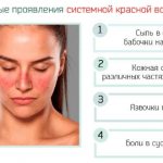 Симптомы волчанки