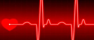 Sinus arrhythmia