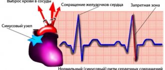 Синусовый узел