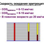 Erythrocyte sedimentation rate