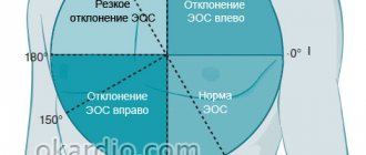 смещения ЭОС
