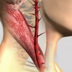 carotid artery
