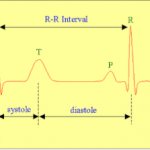 Correlation of ECG intervals with the phases of the cardiac cycle (ventricular systole and diastole).