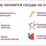 сосуды на ногах