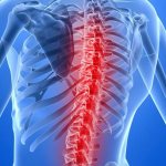 Spinal stroke. Aksimed.ua. 