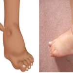 Method for determining swelling