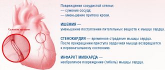 Subendocardial ischemia on the ECG. What it is