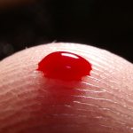 Blood clotting: general analysis