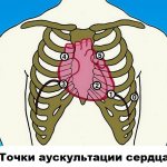 Heart auscultation points