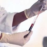 Thrombin time is increased