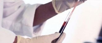 Thrombin time is increased