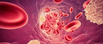 Thrombocytopenia. Causes, symptoms, diagnosis and treatment.