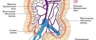 Intestinal thrombosis