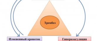 Intestinal thrombosis