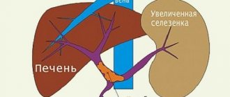 Тромбоз портальной вены не такое уж и редкое явление.