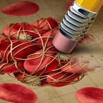 Thrombosis of arteries and veins