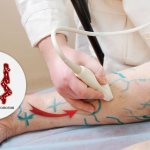 Doppler ultrasound or Doppler ultrasound