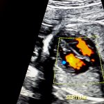 Ultrasound of the fetal heart in Europe