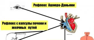 Вагусные пробы при тахикардии, аритмии, экстрасистолии, ВПВ у взрослых. Что это такое, противопоказания