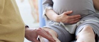 Varicose veins and pregnancy
