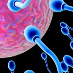 The effect of varicocele on conception: is it possible to have children?