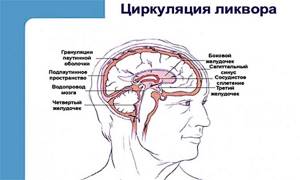 Черепное давление картинки