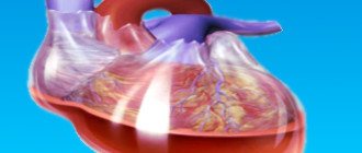 Intracavitary bleeding