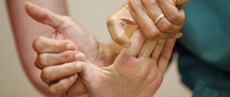 Restoring a hand after a stroke