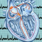 Воздушная эмболия проявления