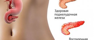 Diseases of the pancreas are accompanied by an increase in diastase in the blood