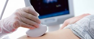 Frozen pregnancy - causes and consequences 4