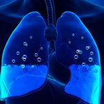 Fluid in the lungs