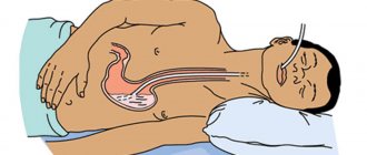 tube feeding