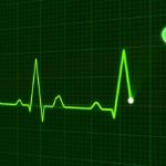 Зубцы, сегменты ЭКГ